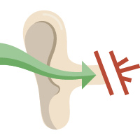 Blockage can be a cause of tinnitus